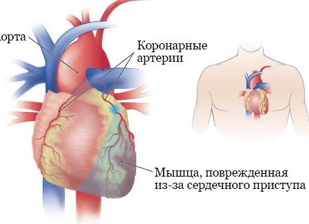 Давайте выпьем за здоровье! Что пить, чтобы было полезно
