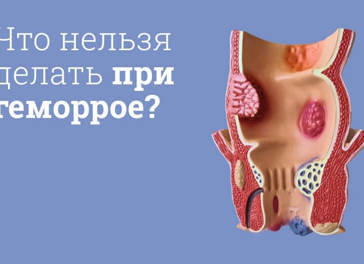 Продукты которые нежелательно есть при геморрое